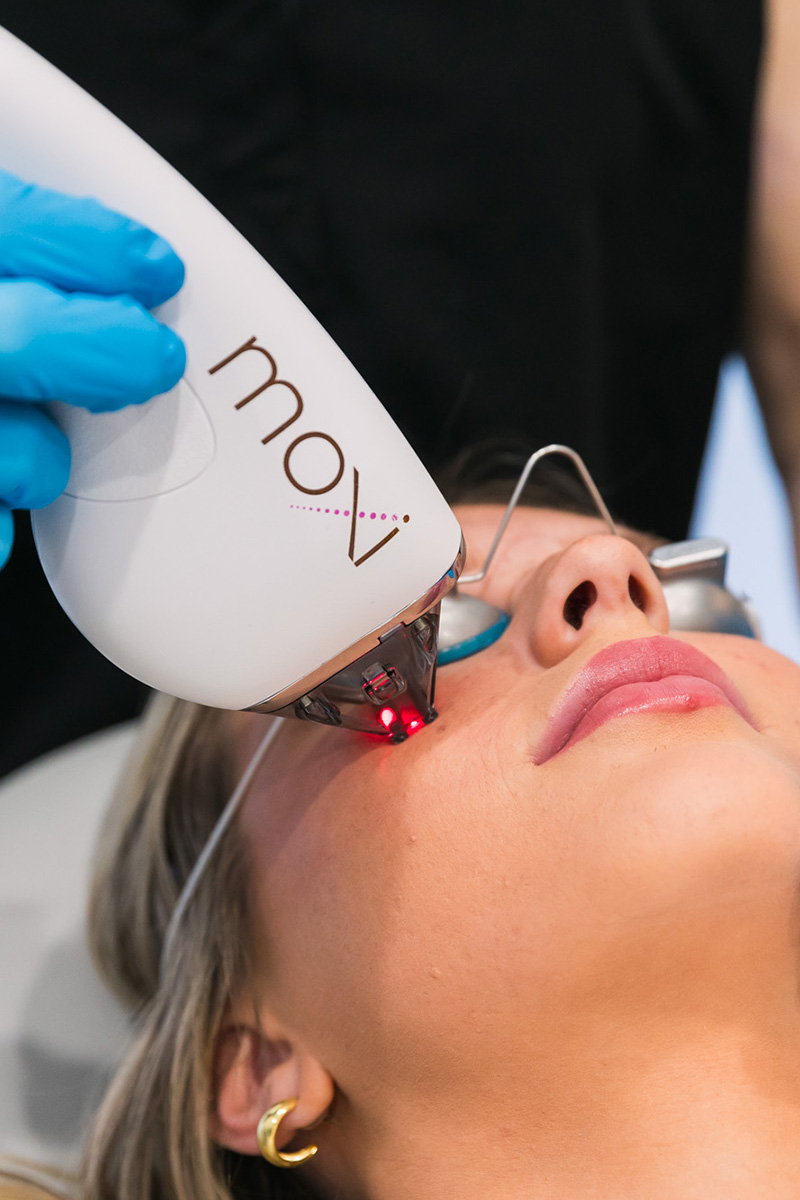 a woman receiving MOXI laser skin treatment at Evolve Aesthetics & Wellness