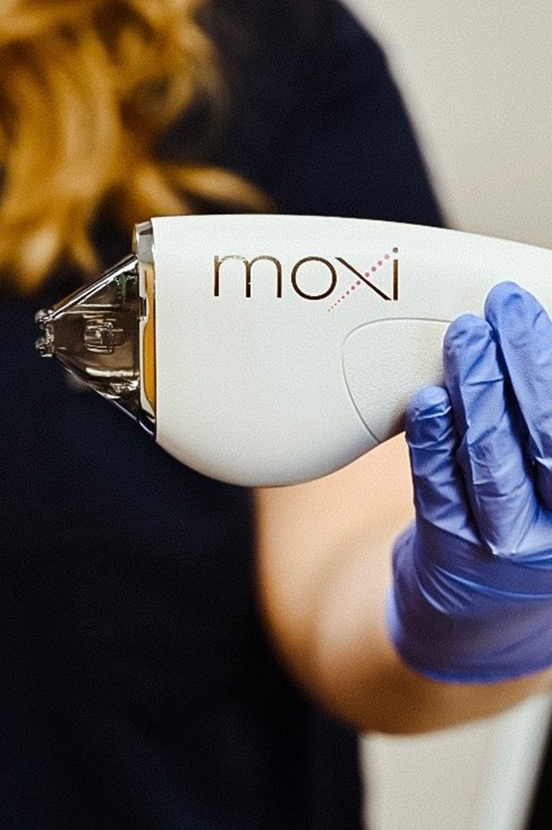 an Evolve Aesthetics team member holding a MOXI laser treatment device