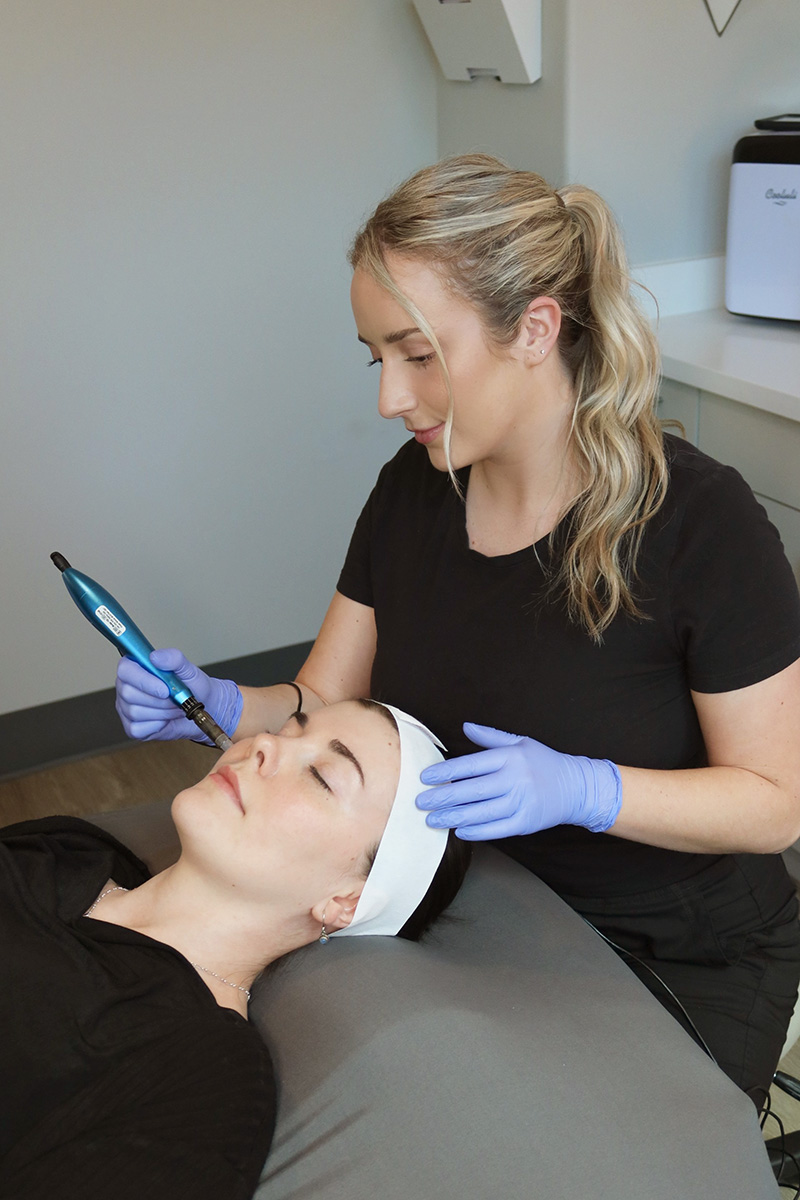 a woman receiving a microneedling treatment from an Evolve Aesthetics expert a woman receiving a microneedling treatment from an Evolve Aesthetics expert
