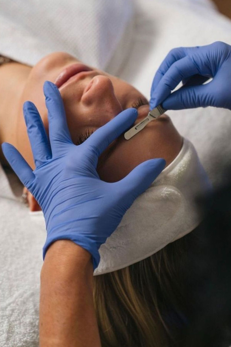 a patient receiving dermaplaning treatment from an Evolve Aesthetics & Wellness aesthetician