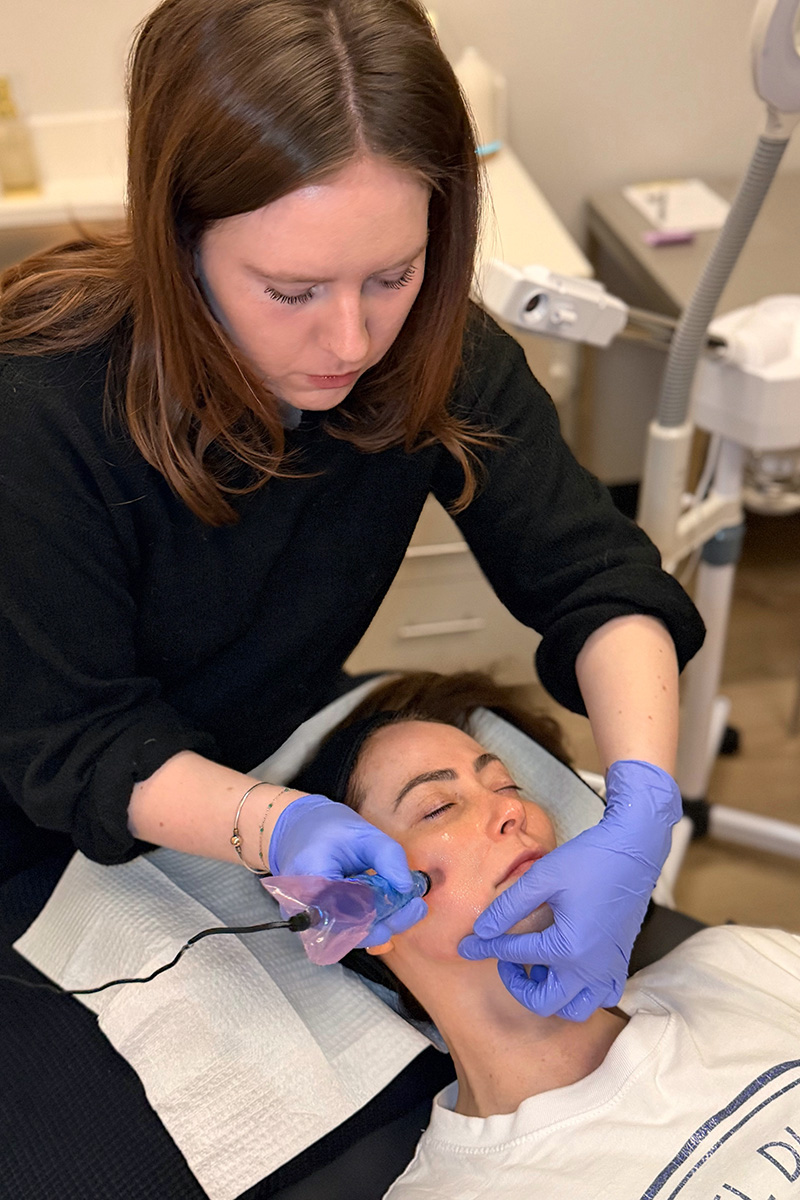 an Evolve Aesthetics & Wellness aesthetician performing a microneedling treatment